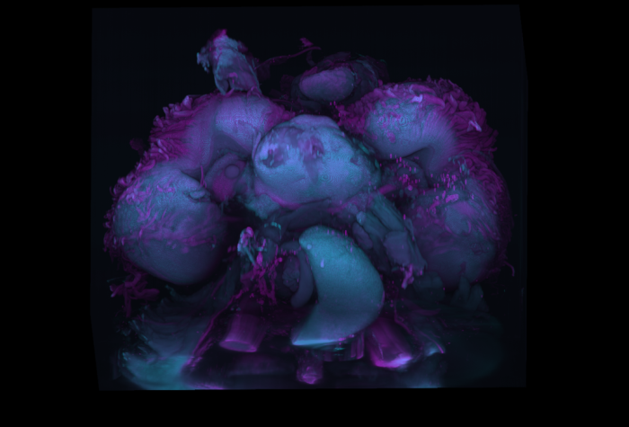 Le projet SOFF ATLAS soutenu par la Fondation 1432